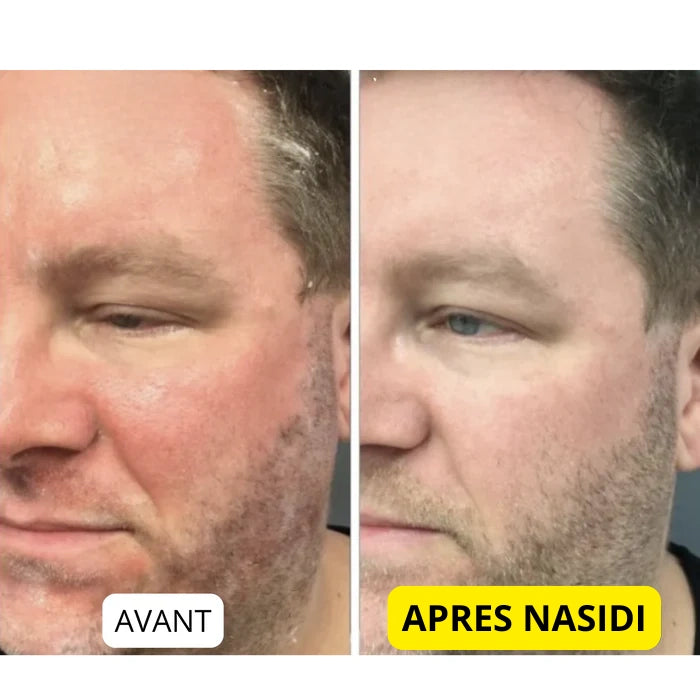 NASIDI ⎜ Barbe & cuir chevelu apaisés