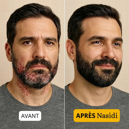 NASIDI ⎜ Barbe & cuir chevelu apaisés